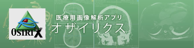 医用画像解析アプリ「オザイリクス(OsiriX)」